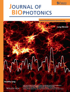 Zum Artikel "Front Cover page in the Journal of Biophotonics"